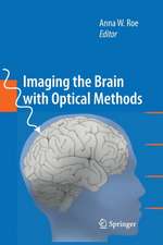 Imaging the Brain with Optical Methods