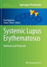 Systemic Lupus Erythematosus: Methods and Protocols