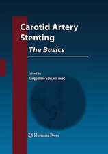 Carotid Artery Stenting: The Basics