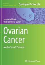 Ovarian Cancer: Methods and Protocols