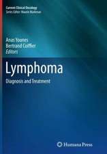 Lymphoma: Diagnosis and Treatment