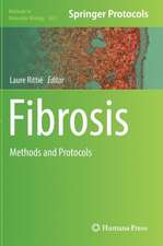 Fibrosis: Methods and Protocols