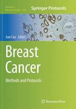 Breast Cancer: Methods and Protocols