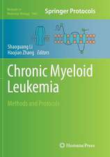 Chronic Myeloid Leukemia: Methods and Protocols