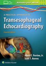 A Practical Approach to Transesophageal Echocardiography