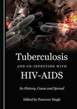 Tuberculosis and Co-infection with HIV-AIDS