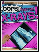 Oops! They're X-Rays!