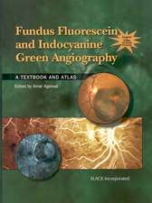 Fundus Fluorescein and Indocyanine Green Angiography: A Textbook and Atlas