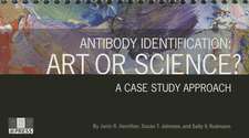 Antibody Identification