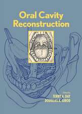 Oral Cavity Reconstruction