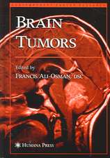 Brain Tumors