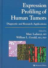 Expression Profiling of Human Tumors: Diagnostic and Research Applications