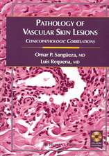 Pathology of Vascular Skin Lesions