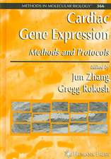 Cardiac Gene Expression: Methods and Protocols