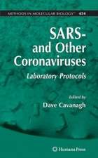 SARS- and Other Coronaviruses: Laboratory Protocols