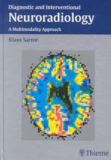 Diagnostic and Interventional Neuroradiology