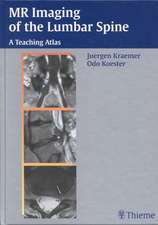 MR Imaging of the Lumbar Spine: A Teaching Atlas