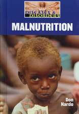 Malnutrition