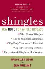 Shingles