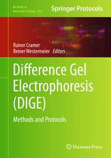 Difference Gel Electrophoresis (DIGE): Methods and Protocols