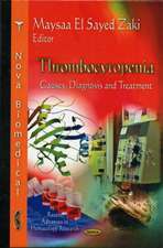 Thrombocytopenia