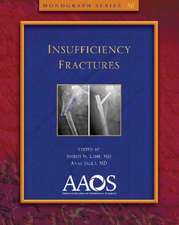 Insufficiency Fractures