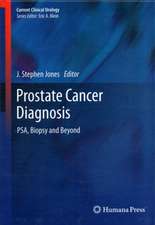 Prostate Cancer Diagnosis: PSA, Biopsy and Beyond