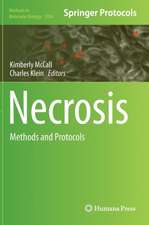 Necrosis: Methods and Protocols