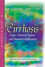 Cirrhosis