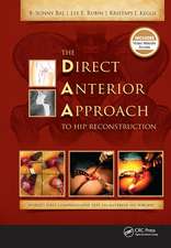 The Direct Anterior Approach to Hip Reconstruction