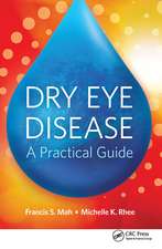 Dry Eye Disease: A Practical Guide