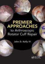 Premier Approaches to Arthroscopic Rotator Cuff Repair