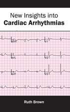 New Insights Into Cardiac Arrhythmias: Clinical and Biological Characteristics