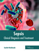 Sepsis