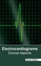 Electrocardiograms