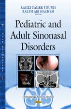 Paranasal Sinuses: Anatomy, Development & Biological Function