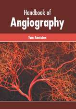 Handbook of Angiography