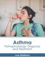 Asthma: Pathophysiology, Diagnosis and Treatment