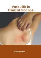 Vasculitis in Clinical Practice