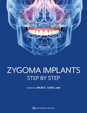 Zygoma Implants: Step by Step