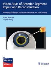 Video Atlas of Anterior Segment Repair and Recon – Managing Challenges in Cornea, Glaucoma, and Lens Surgery