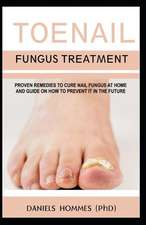 Toenail Fungus Treatment: Proven Remedies to Cure Nail Fungus at Home and Guide on How to Prevent It in the Future