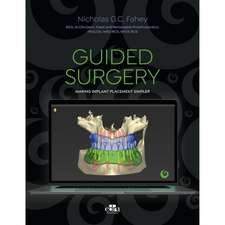 Guided Surgery - Making Implant Placement Simpler