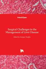 Surgical Challenges in the Management of Liver Disease