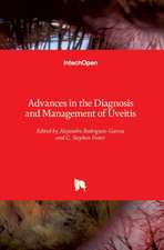 Advances in the Diagnosis and Management of Uveitis