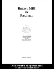 Breast MRI in Practice