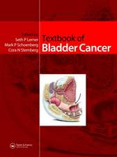 Textbook of Bladder Cancer