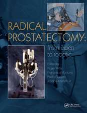 Radical Prostatectomy: From Open to Robotic