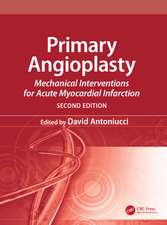 Primary Angioplasty: Mechanical Interventions for Acute Myocardial Infarction, Second Edition