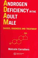 Androgen Deficiency in The Adult Male: Causes, Diagnosis and Treatment